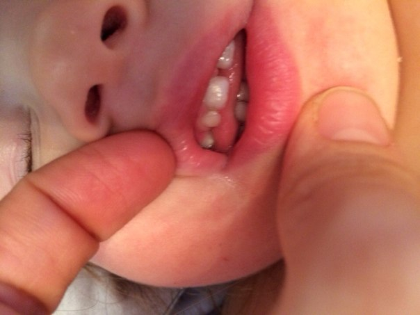 Проблемы с зубами, нам 1,8.