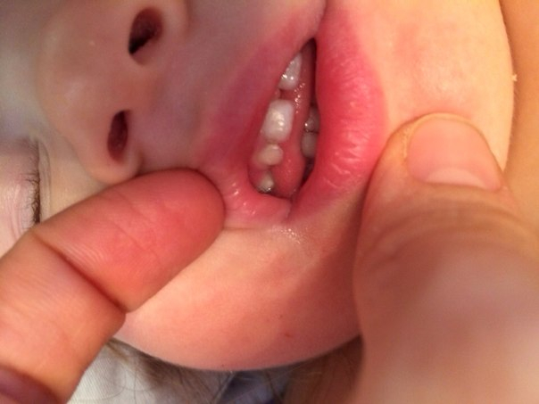 Проблемы с зубами, нам 1,8.