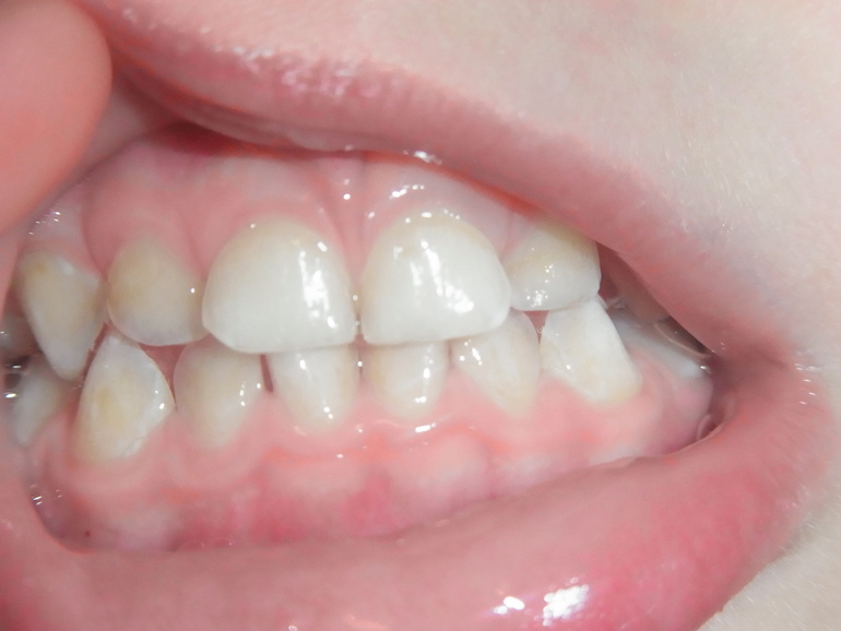 Что делать?