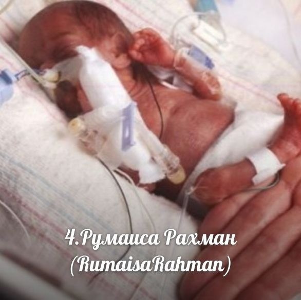 Самые необычные дети мира.
