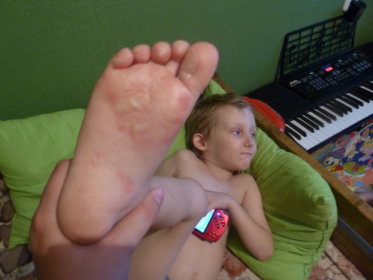 не бывает отдых без приключений