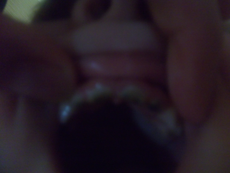 Фотографии Петеных зубов