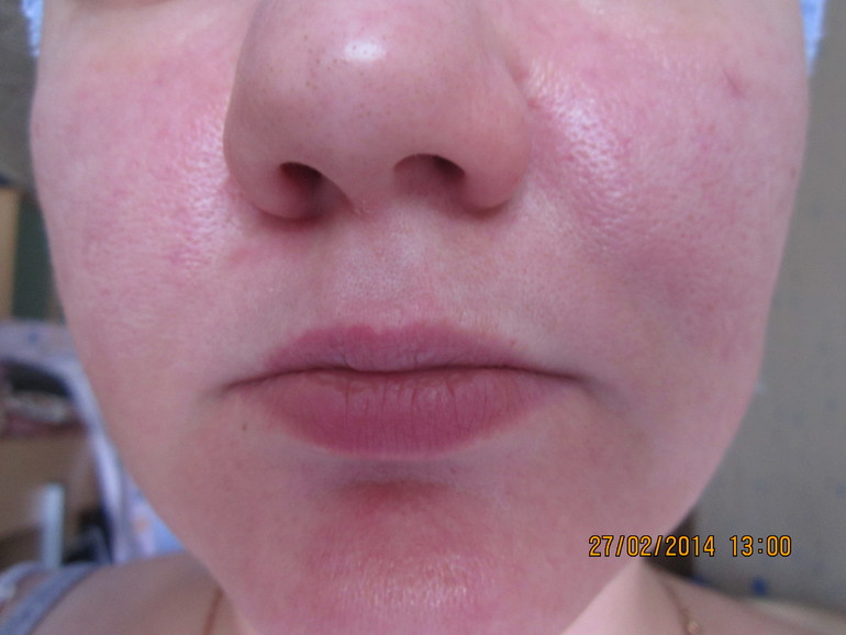 что можно сделать с этим?