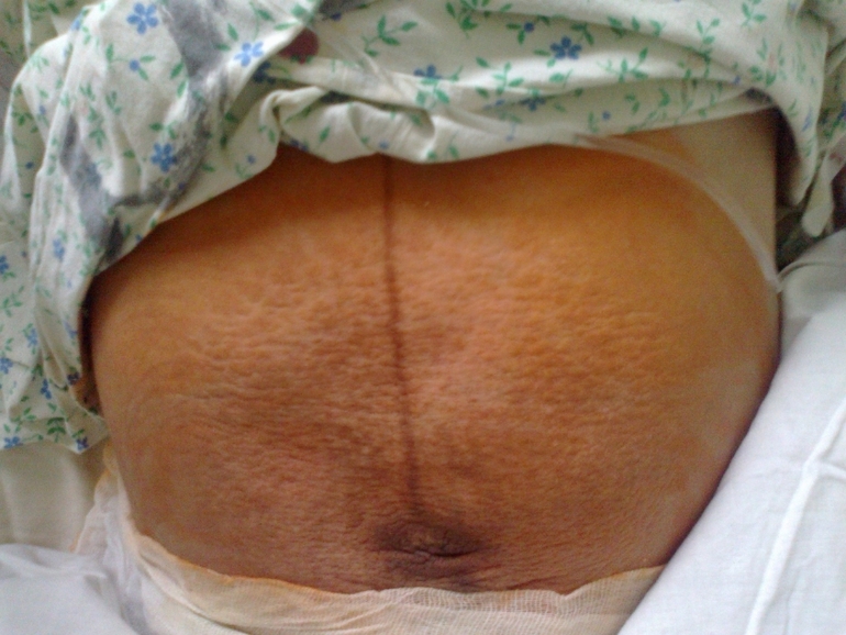 Давно зрел пост...