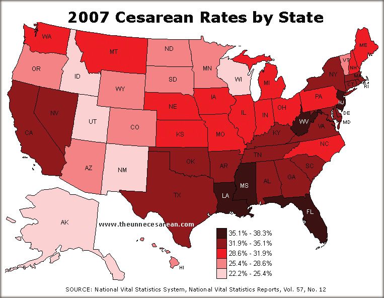 Статистика проведения кесарева сечения и естественных родов по США.