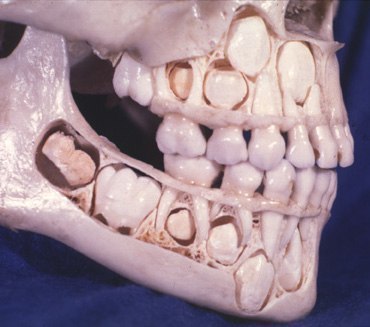 Молочные зубки.