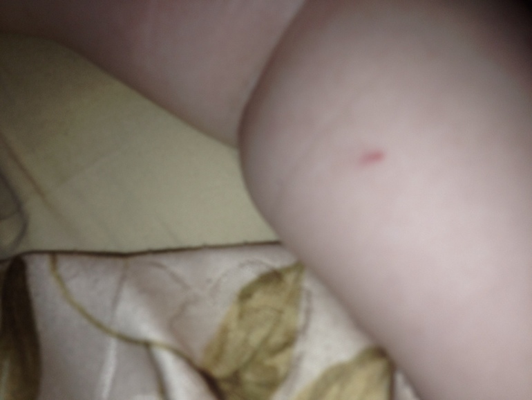 Вопрос о Манту