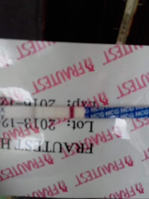 Бхб номер 1. 16 ДПО, задержка второй фазы 2 дня.