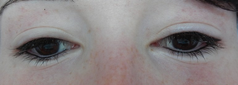 Межресничное пространство и стрелки.