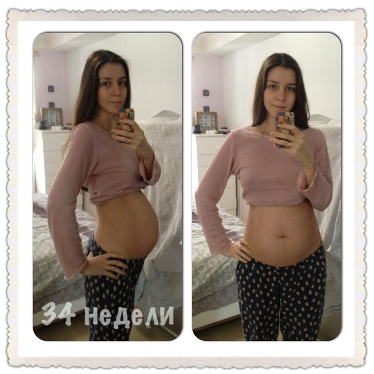 34 недельки!
