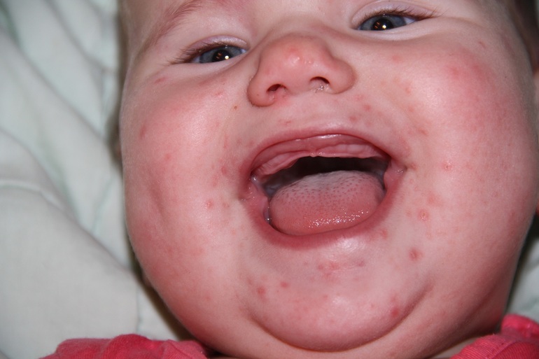 что с деснами??? Очень нужна ваша помощь!