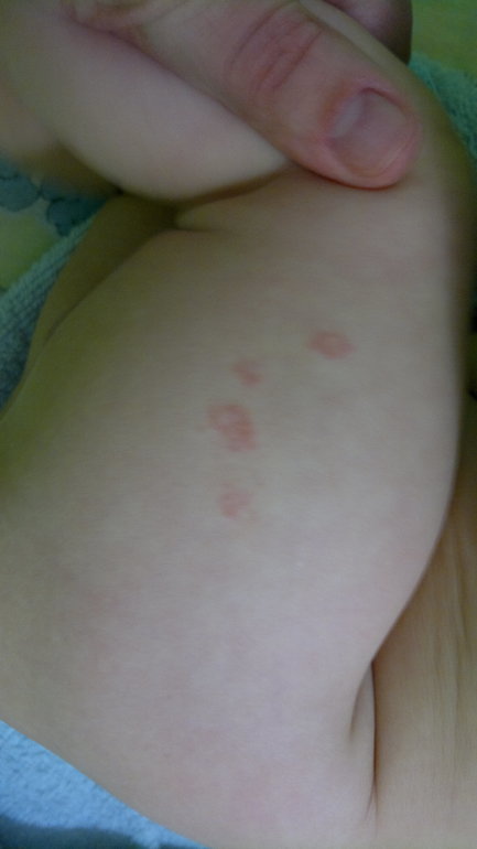 Красные шероховатые неровности на ножках