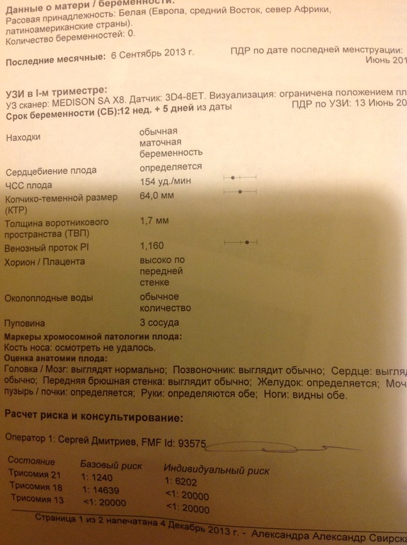 Мое узи, второе....