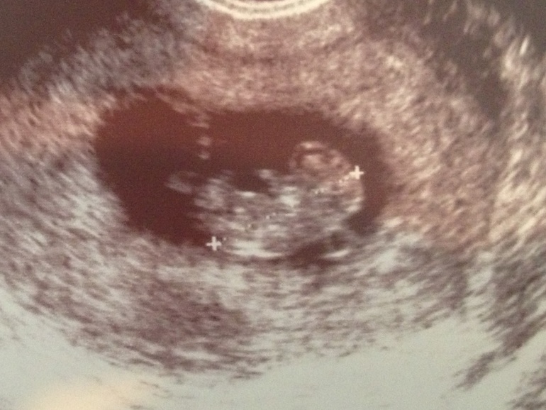 Сходила на свидание с малышом!!!! Мы такие класные!!!