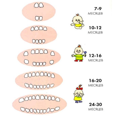 порядок прорезывания зубов