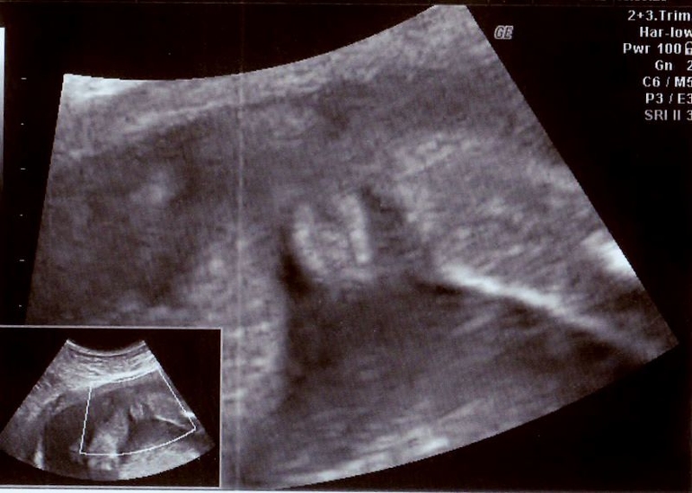 Мандариновые дольки