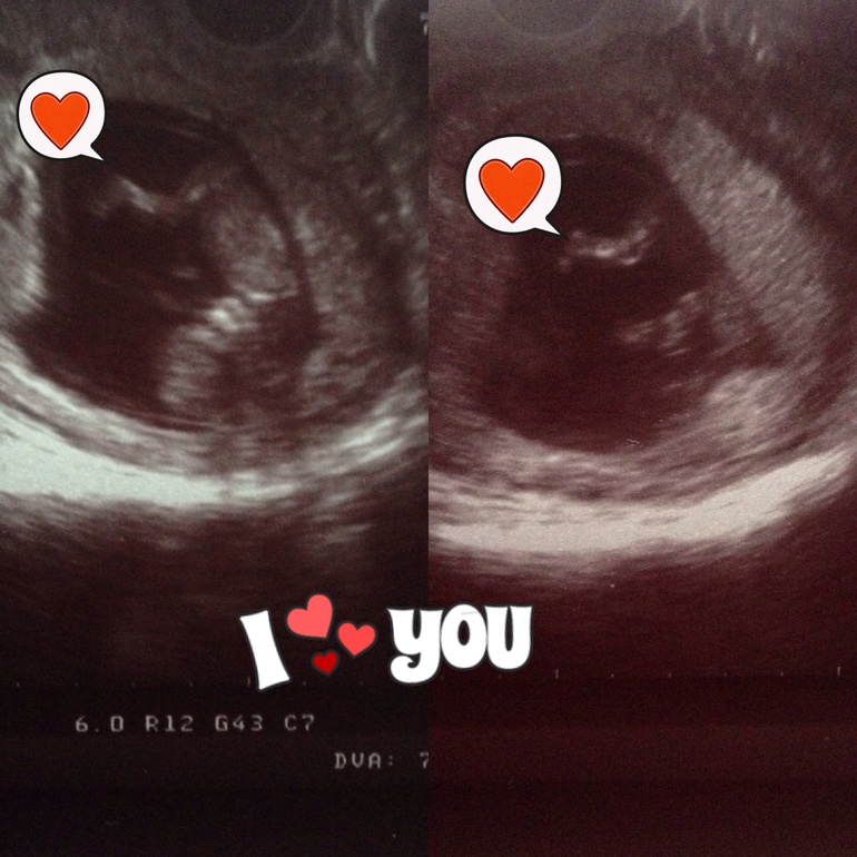 Любимые пяточки!