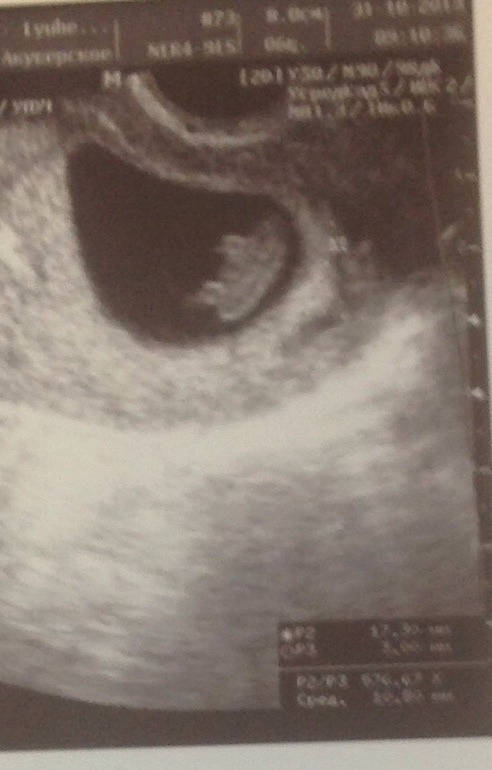 8 недель и 6 дней