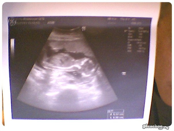 Не было бы счастья))