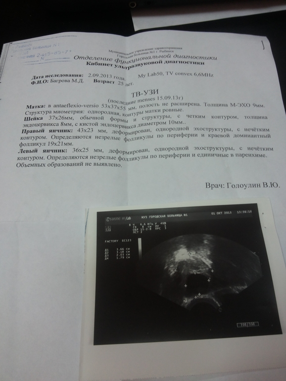 Приехала с УЗи ....растроена-это мало сказано....