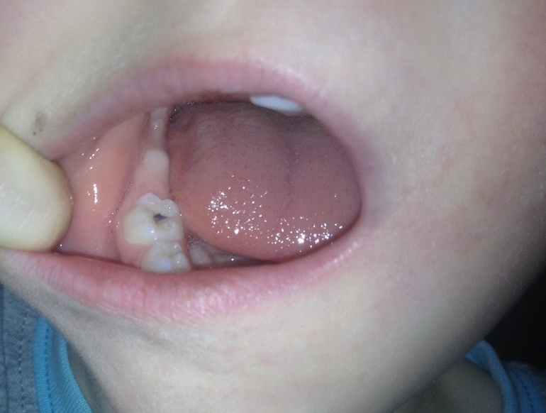 Алина, проконсультируйте, пожалуйста