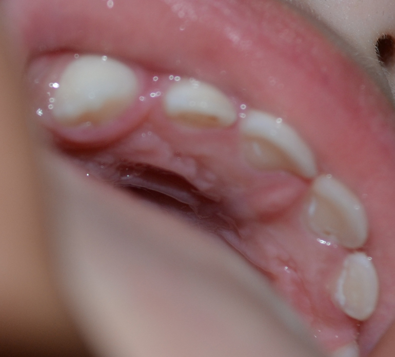 1e7334dea90fc653e0f37a2091c4e45d.jpg