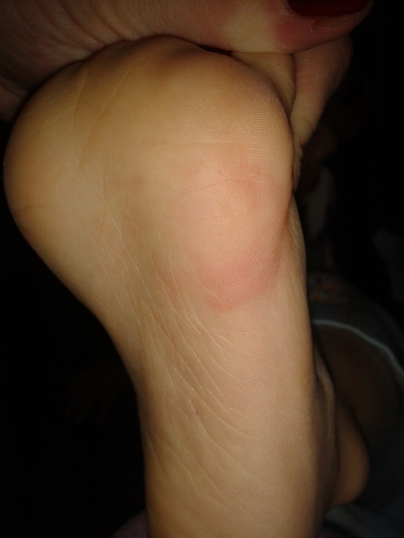 Что это? Нарыв?