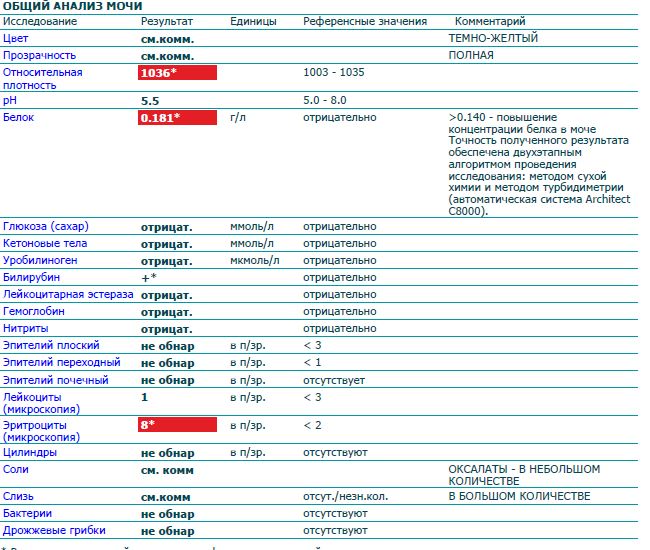 В моче повышены лейкоциты и нитриты. Лейкоцитарная эстераза в моче у женщины. Лейкоцитарная эстераза ++ и лейкоциты в моче. Общий анализ мочи проведение анализа. Эстераза лейкоцитов в моче.