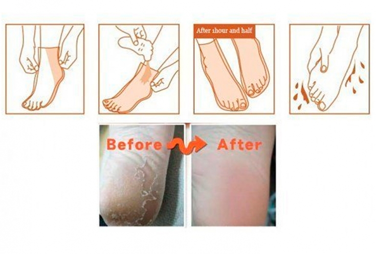 Носочки педикюрные -пилинг ( Корея) в наличии.