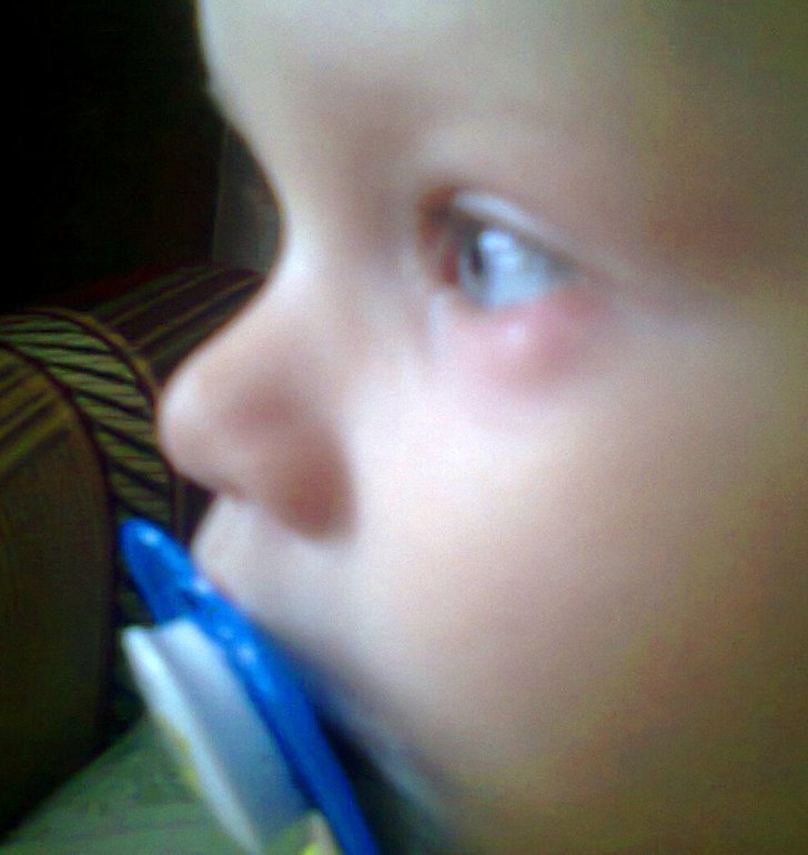 Ячмень что ли???