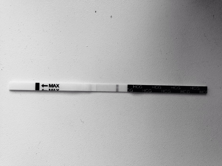 тест на беременность на 11 день после овуляции. 11 дпо тест. 11 день дпо тест. 12 дпо тест. 11 дпо тест положительный.