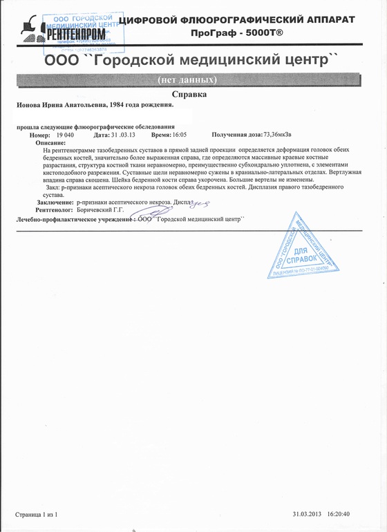Ирина, 28 лет, собираем средства на тазобедренные эндопротезы