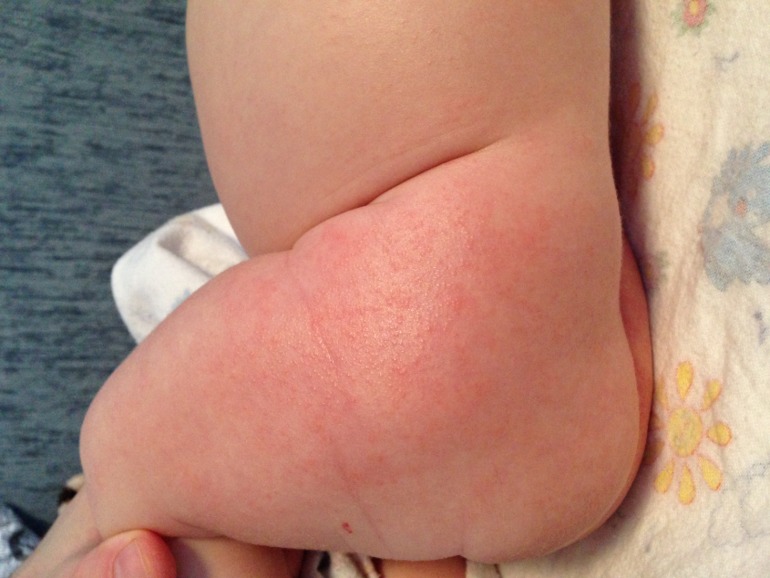 Девочки, подскажите, пожалуйста, что это может быть?