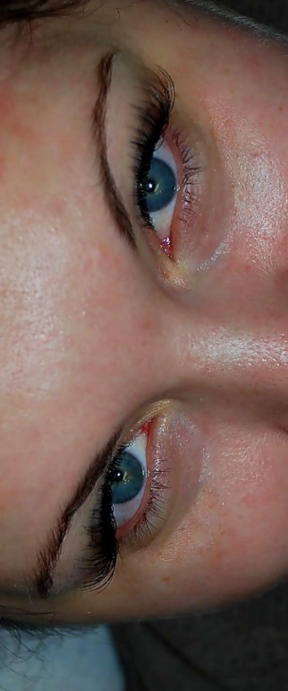 Лисий взгляд