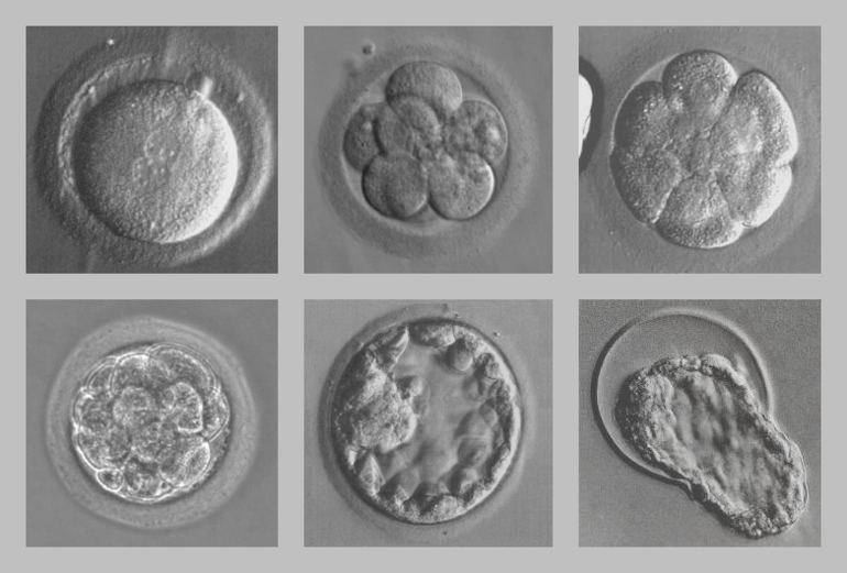 3 5 дней после. Эмбрион бластоциста. Бластоциста клеточный эмбрион. Эмбрион бластоциста 2. Эко ИКСИ стадии развития эмбриона.