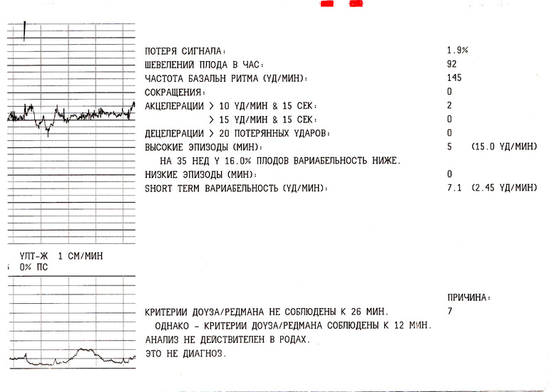 Что значит на ктг критерии не соблюдены