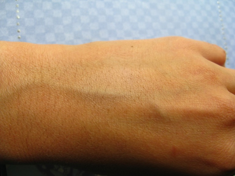 Корректоры под глаза от синячков