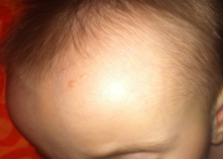 Родинка или что то другое ?