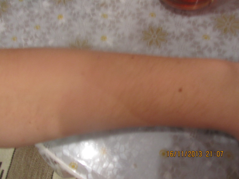 Удаляем над губой.....))))