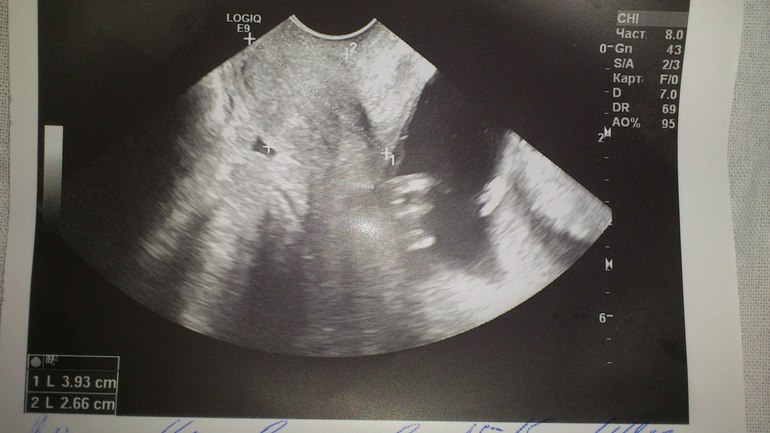 напишу и я наши новостя)))