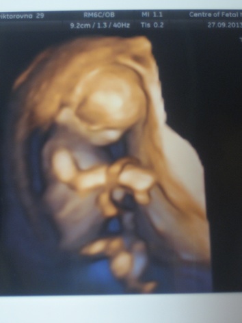 Этап "УЗИ-скриннинг" пройден!!