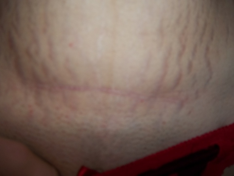 11 месяцев спустя=)