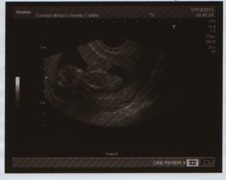 Наш 1 скрининг)))