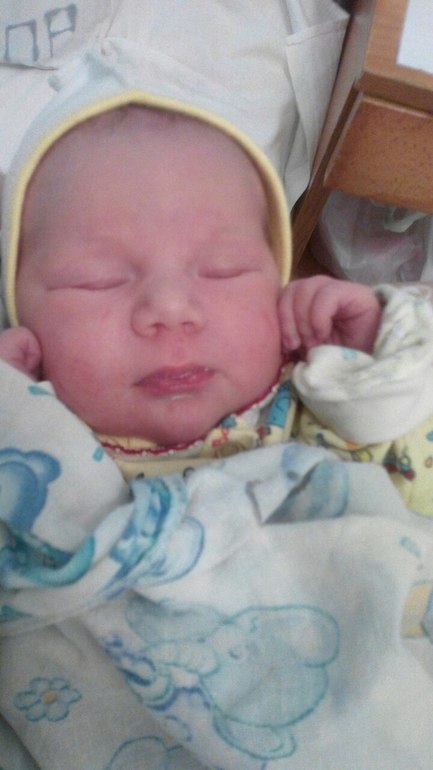 Отек глаз у новорожденного — 16 ответов | форум Babyblog
