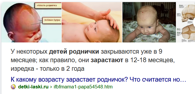 Родничок у детей. Всё, что нужно знать родителям