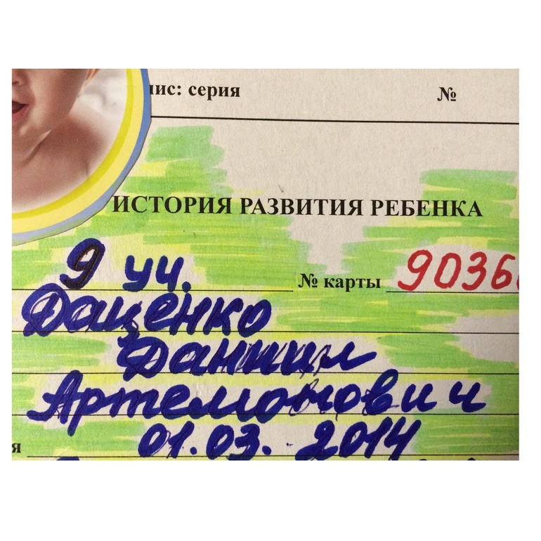Казус