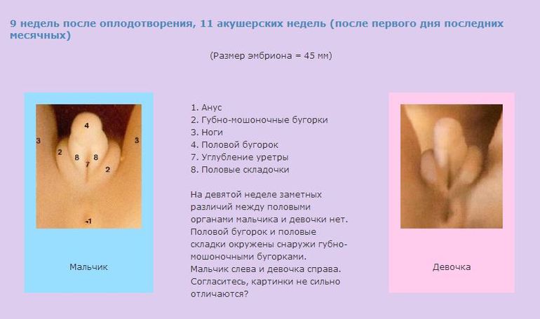 раннее определение пола