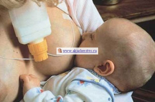 Система кормления SNS Medela