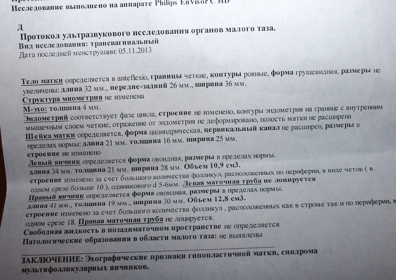Результты узи