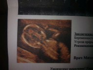Фото УЗИ на 15 неделе беременности